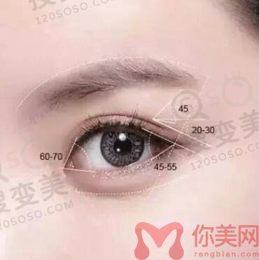 四川米兰柏羽双眼皮谁做的好?