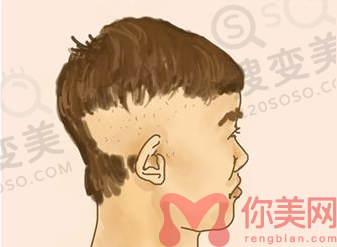 厦门植发哪里比较好？