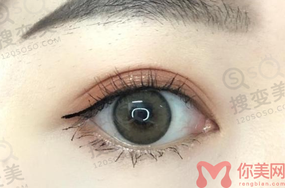 北京炫美整形是正规医院吗？