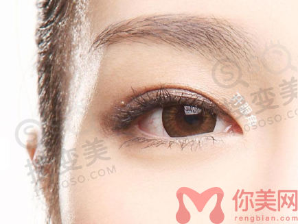 北京丽都双眼皮手术怎么样？