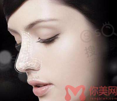 贵阳隆鼻怎么选择医院和医生？