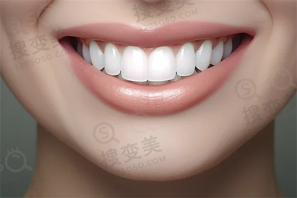 语法小精灵