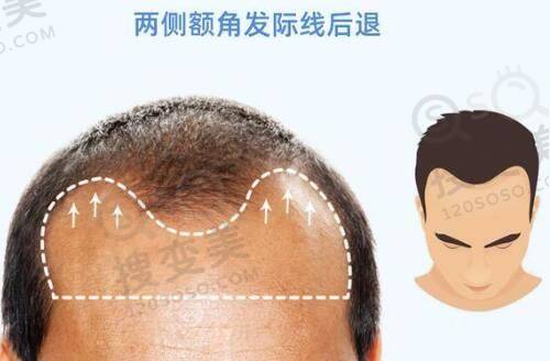 西安市中 心医院烧伤整形科——当地老牌重点整形科室