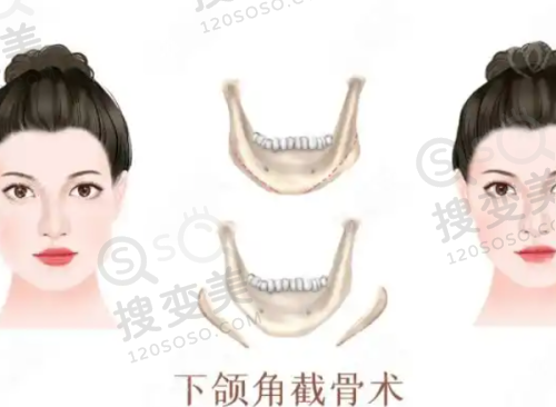 温州艺星整形医院周到且贴心的服务质量