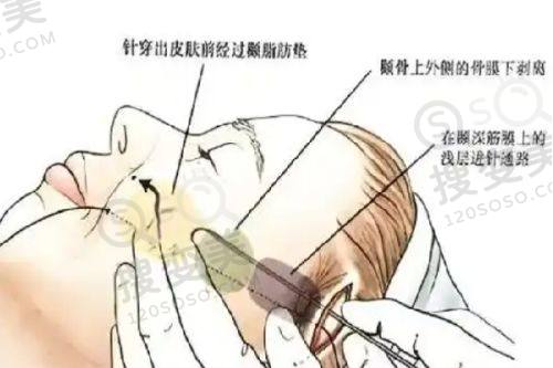 2025年广州荔湾清奥中心可信吗？医生技术优、收费8800起，口碑好评如潮 