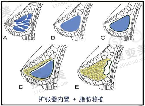 广州荔湾清奥中 心正规吗？