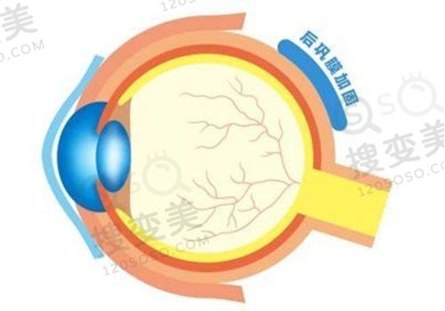 乌鲁木齐空军 医院做近视眼手术怎么样
