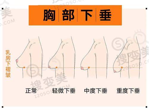 合肥竹一医疗美容——多层羽毛拉皮特色医院