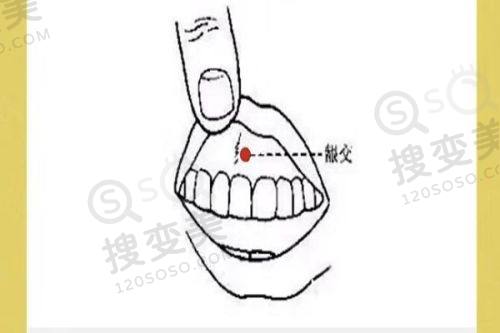 2025南京十大双眼皮医生排名揭晓：艺星汪树杰等擅多技术，预约享模拟设计