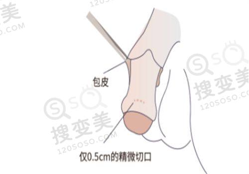 上海伯思立医疗美容——特色拉皮手术医院