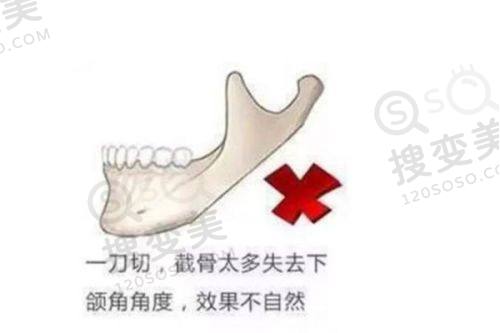 解国内这六家当地排行靠前的拉皮手术医院，含特色技术及医生优势揭秘 
