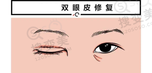 北京黄寺医疗美容——实力强劲的拉皮手术医院