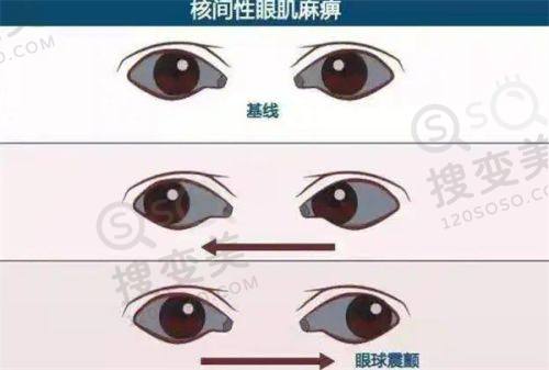复旦大学眼科医院基本信息