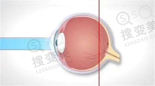 2025年爱尔眼科医院费用价目表大揭秘 - 多种眼科手术收费透明，技术优获患者好评