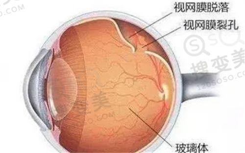 四、贵州省人民医院做近视手术的优势