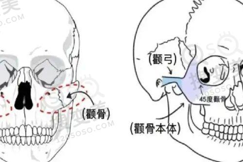北京爱慕医疗美容隆鼻价格是否合理
