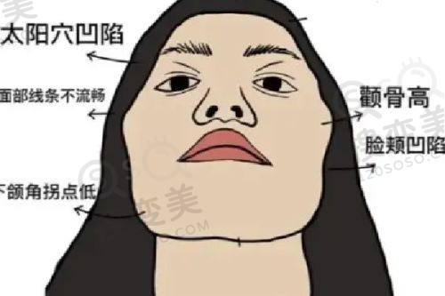 晋中德尔美客医疗美容双眼皮价格表,正规医院技术优效果好可预约