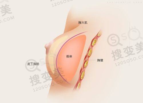 重庆松山医院双眼皮修复怎么样?真实实例/价格分享之秦伟医生