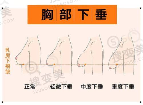 重庆松山医院正颌手术肖林，20年零失误，3D导航打造绝美侧颜，价格4万起——杜绝手术风险的方法