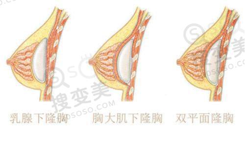 重庆肖林是几级医生?不是一级医生,磨骨正颌手术技术优势显著