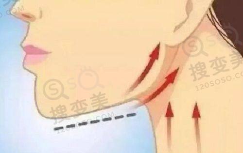 重庆松山医院眼科怎么样?段艳军 医生眼修复技术优,口碑好