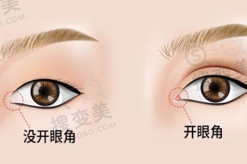 北京亚汇利医疗美容收费标准之其他特色项目