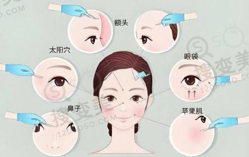 沈阳汇禾医疗美容双眼皮修复价格表之影响因素分析