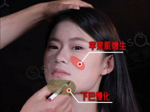 重庆松山医院整形科李凤医生简介，正颌技术过硬无事故收获良好口碑