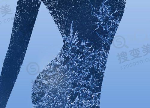 任丘市普济医疗美容双眼皮价格之三点定位双眼皮