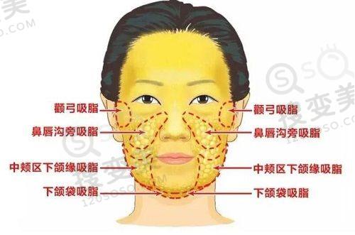 北京亚汇利医疗美容收费标准之整形美容综合项目