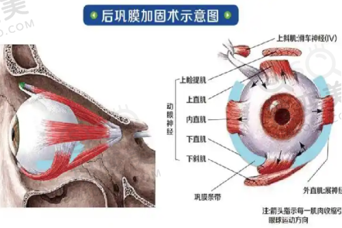 长春做双眼皮价格多少钱?铭医/韩尔等医院技术优、收费合理口碑好