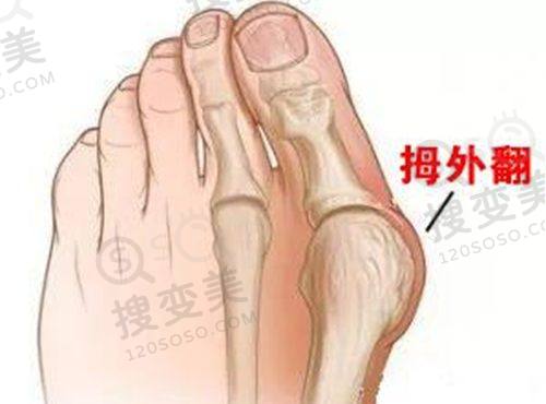 重庆松山医院隆鼻实例分享:价格合理,性价比极高