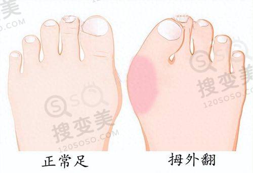 重庆松山医院正颌手术怎么样?肖林医生技术出色