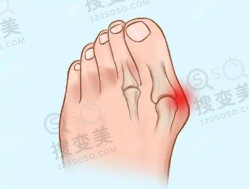 重庆松山医院隆鼻价格如何?段艳军45°高定鼻雕术自然美观!患者评价