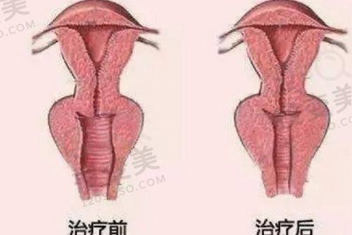 长春做双眼皮价格多少钱——长春韩尔整形美容医院