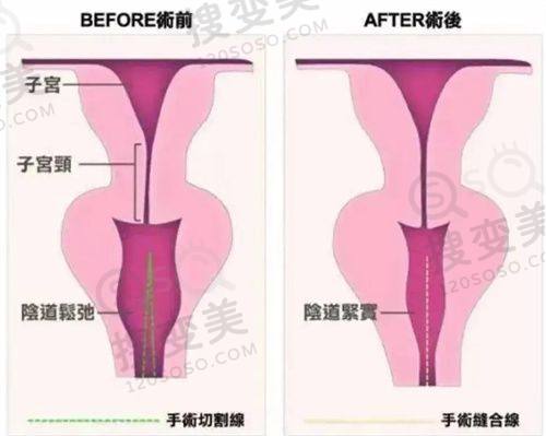 北京亚汇利医疗美容收费标准之价格透明与安心保护