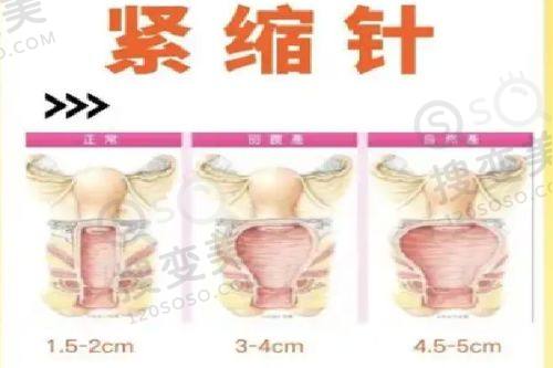 重庆松山医院口腔科医生怎么样？肖林正颌技术强价格亲民口碑好之肖林医生技术优势