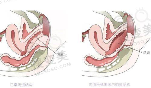 北京瑞妍茗医医疗美容医院价格表之其他美容项目收费