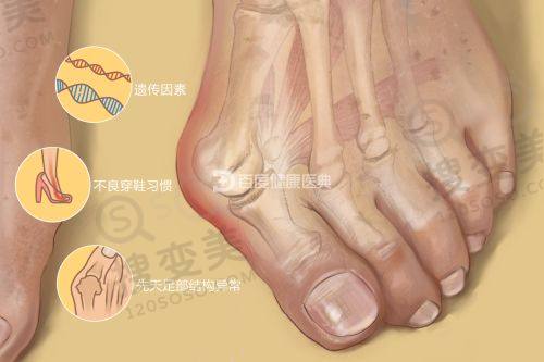 北京赵玉明医疗美容价格表之面部提升项目