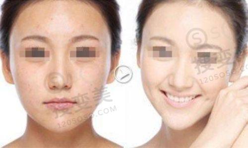 重庆肖林是几级医生?不是一级医生,磨骨正颌术后全方面管理追踪