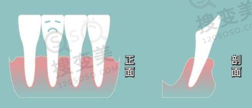 重庆松山整形医院怎么样啊？磨骨正颌技术优——设备精良有优势
