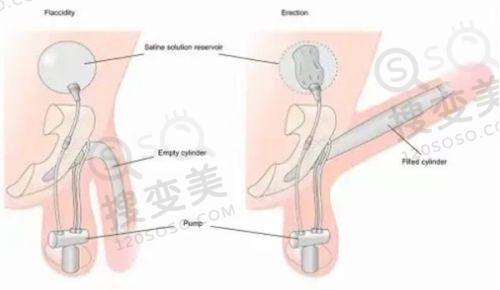 重庆松山医院磨骨医生牛!医院实力强保护技术成效好,口碑佳