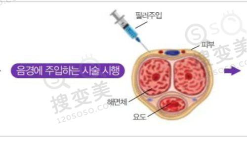 重庆松山医院整形科李凤医生简介：擅长领域广泛