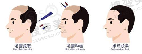 重庆松山医院正颌手术肖林,多项技术护航手术安心与成效