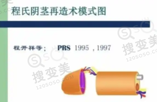 重庆松山口腔科更厉害三个医生之上官文松：数字化磨骨先锋