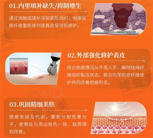 重庆松山口腔医院怎么样?高难度种植牙技术特色突出