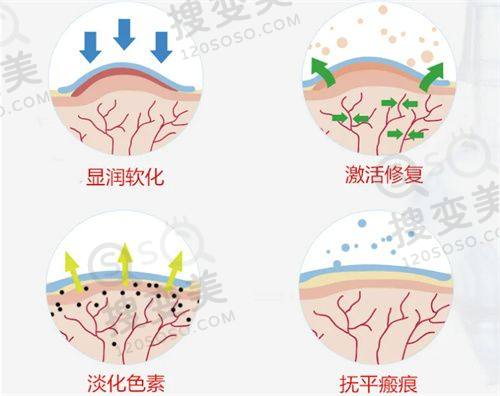 北京晶美医疗美容做双眼皮价格表,埋线3800起,魏志香修复技术佳