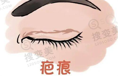 重庆松山医院王涛正颌——柔性技术优势
