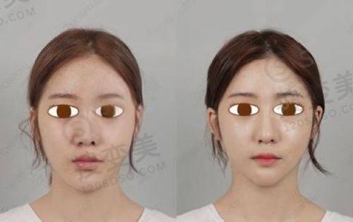 重庆松山口腔医院电话是多少?可预约肖林做地包天矫正,口碑佳——预约方式及注意事项