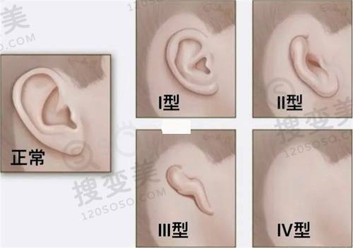 南京栖霞继众诊所收费标准之抽脂整形项目